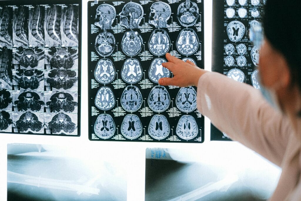 surgical-imaging-by-surgical-guide Radiologist pointing at brain MRI scans showing detailed medical examination.